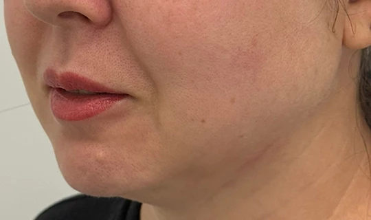 Oligio — Клиника косметологии и дерматологии «Белая косметология»